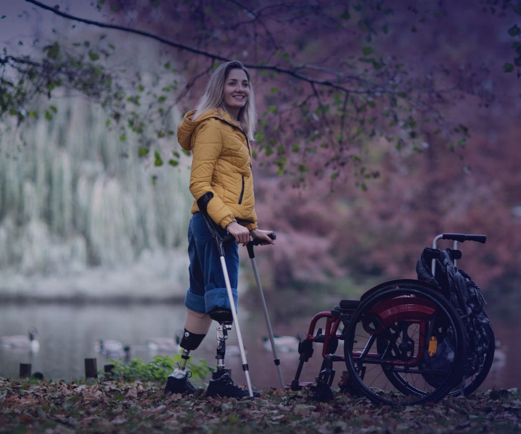 Woman walking with prosthetic leg
